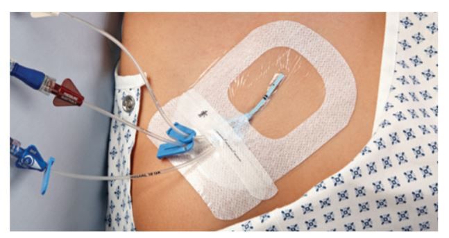 3M 1685 Tegaderm IV Advanced Securement Dressing 11.5cm x 8.5cm- Box o 3M 1685 Tegaderm IV Advanced Securement Dressing 11.5cm x 8.5cm- Box o