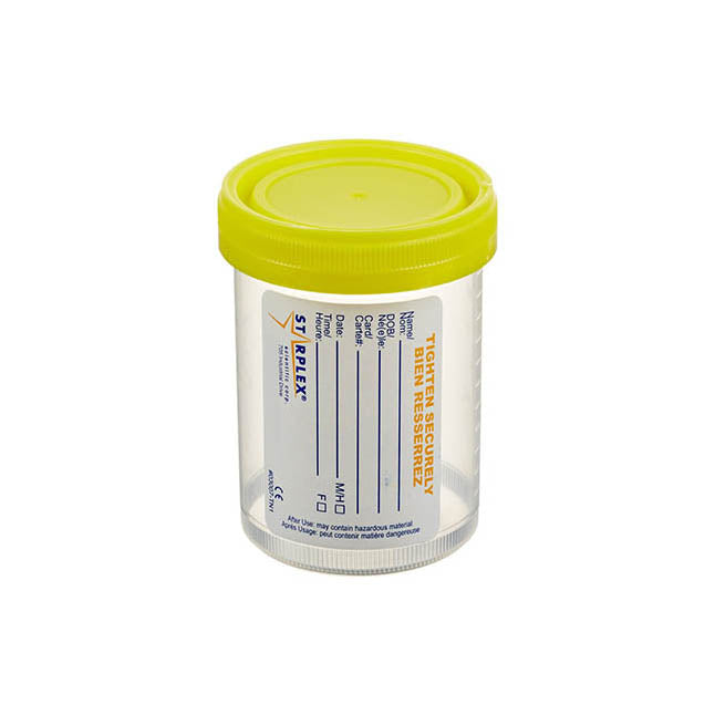yellow capped urine cup on white background
